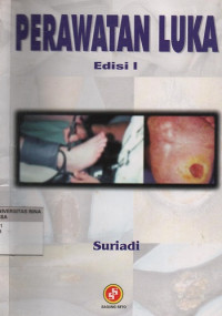 Perawatan Luka